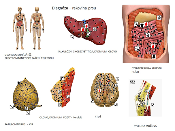 Sensitiv imago 검사 예시